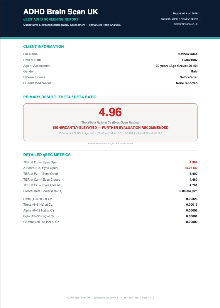 ADHD Brain Scan UK professional PDF report showing theta beta ratio z-scores and normative comparison for ADHD screening