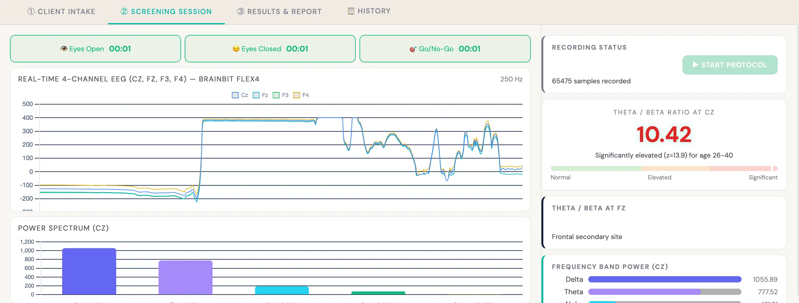 ADHD brain screening dashboard showing real-time theta and beta frequency analysis