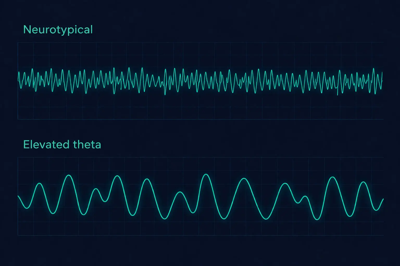 EEG waveform comparison showing slower theta-dominant oscillations in ADHD versus faster beta-dominant neurotypical brain waves